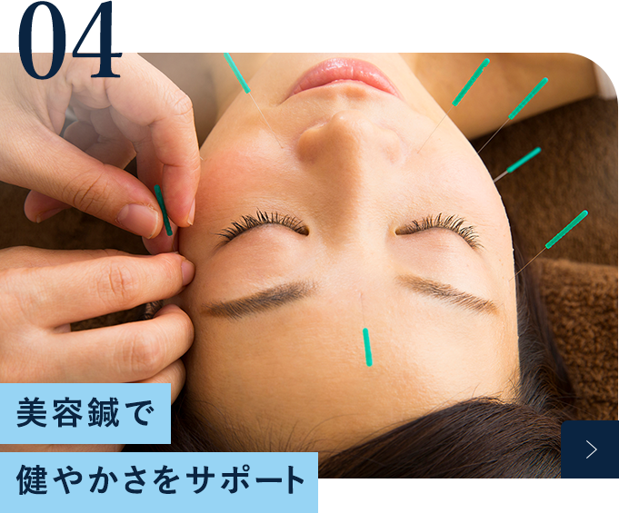 美容鍼で健やかさをサポート